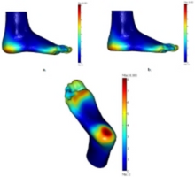 Foot Pressure Sensor