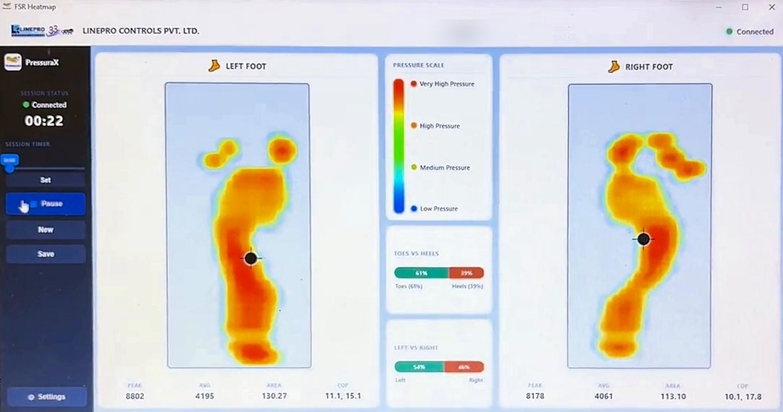 PressuraX software showing left and right foot pressure heatmaps, a pressure scale and distribution bars